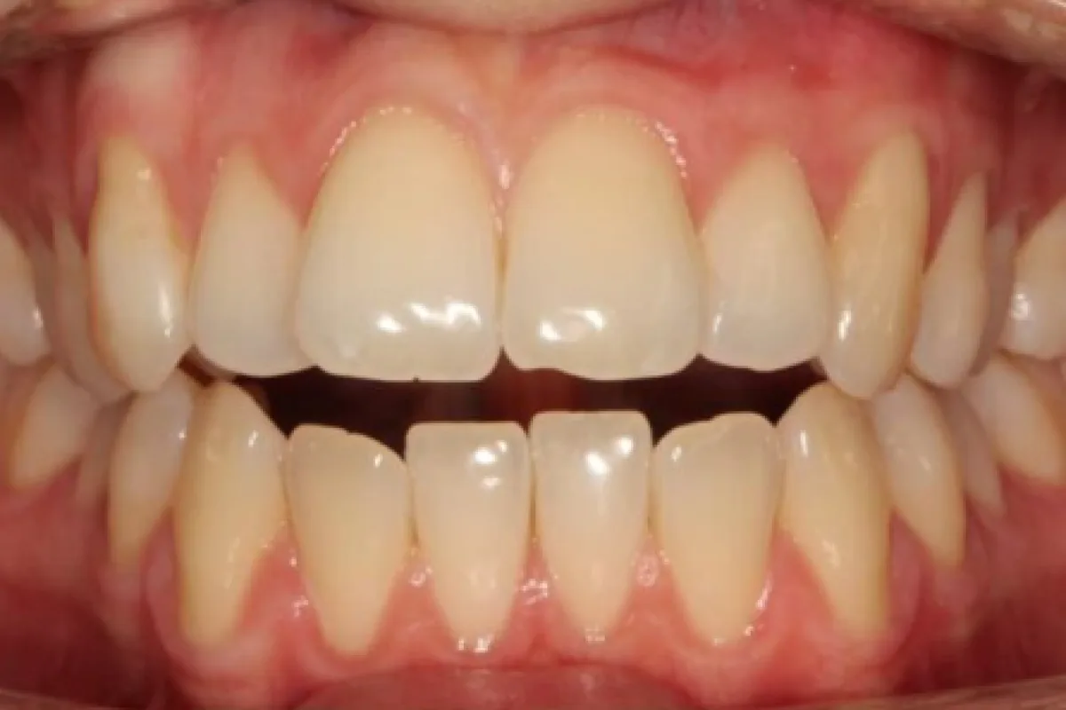 Caso clinico Beatrice