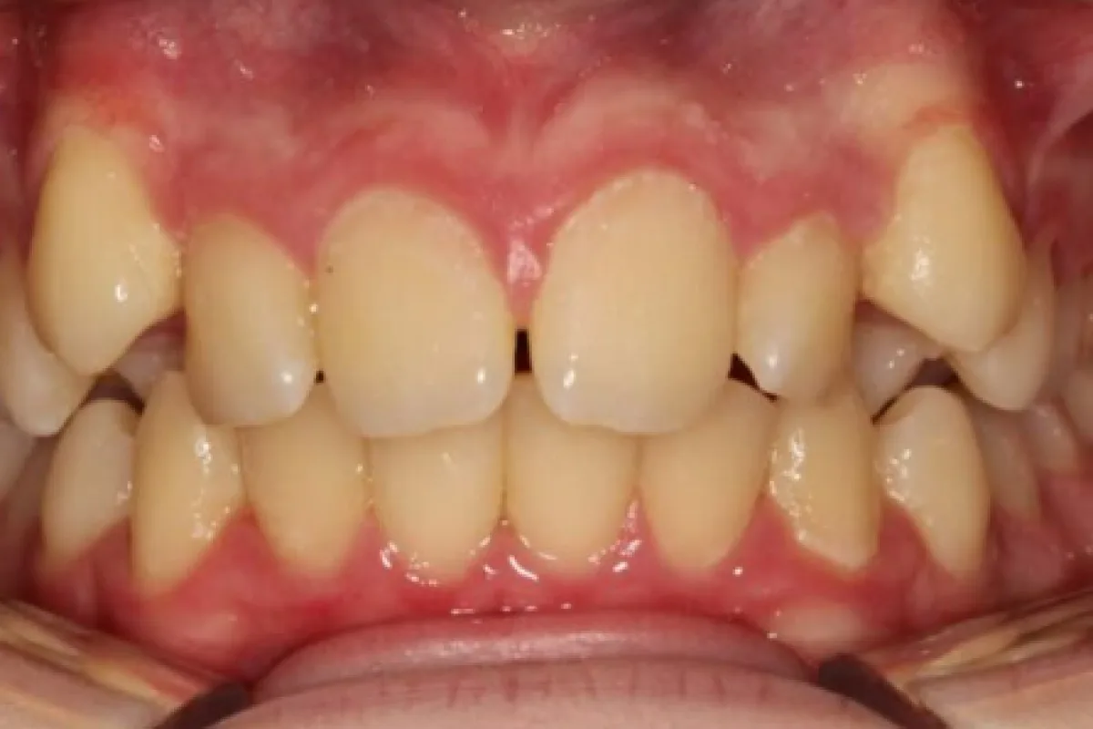 Caso clinico Edoardo